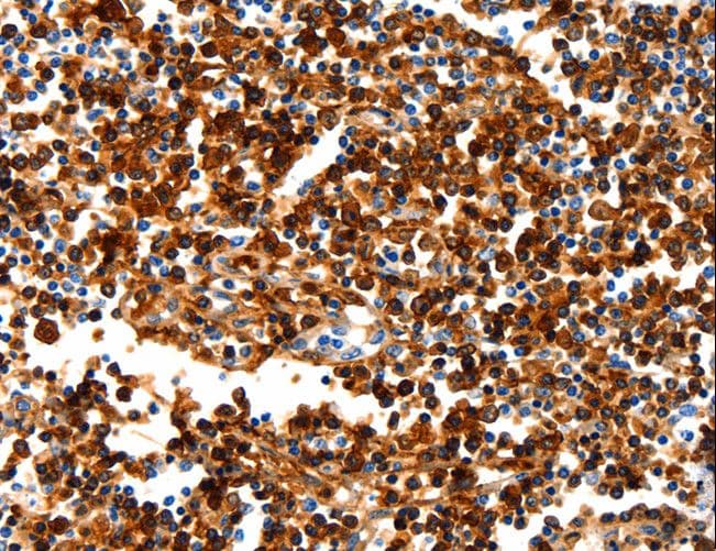 N-CoR / NCOR1 Antibody