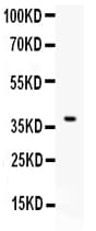 CD86 Antibody