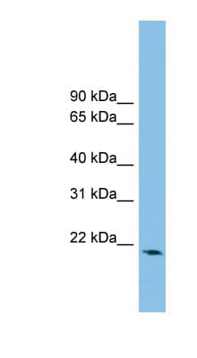 RHOB Antibody (aa107-156)