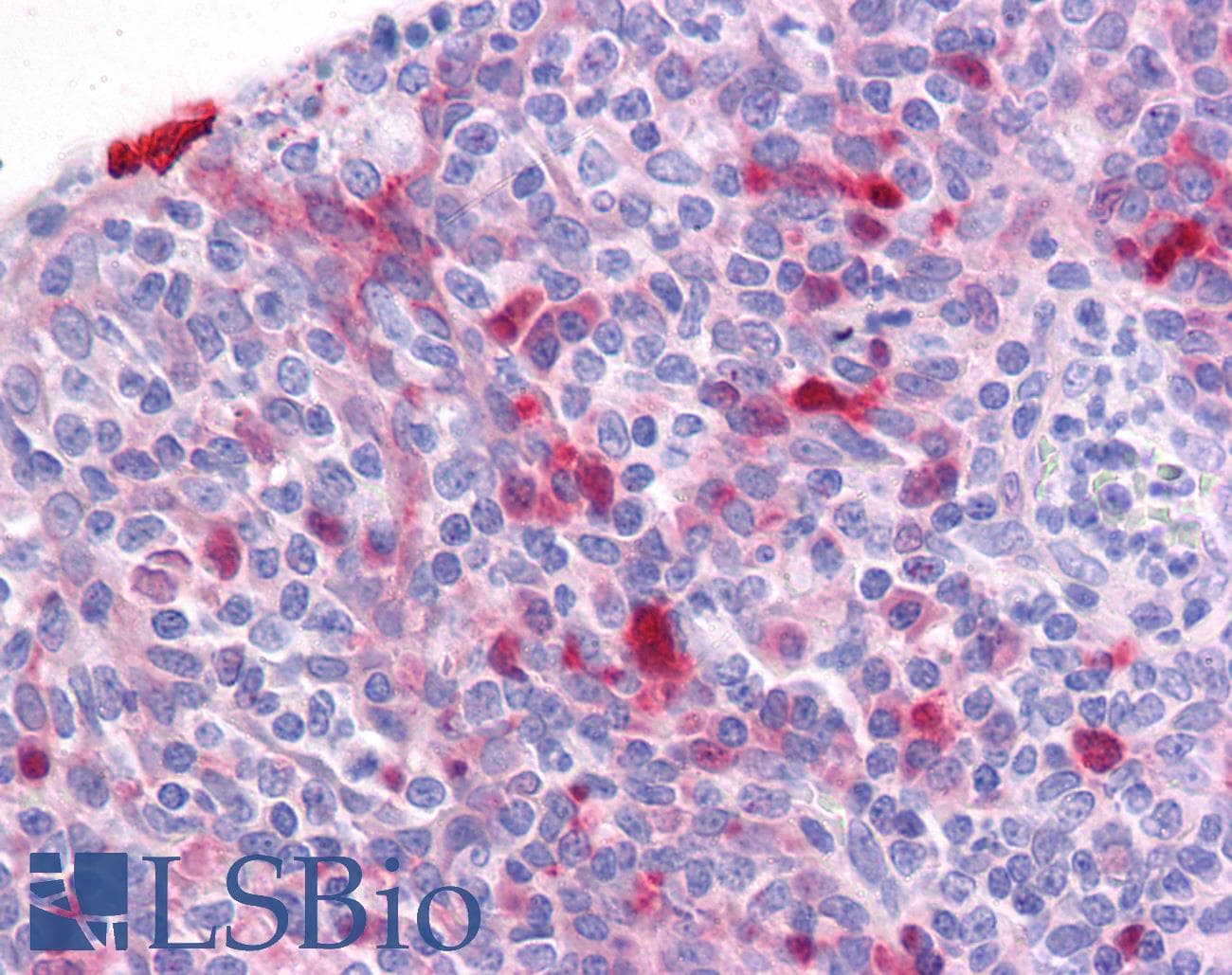 IHC-plus™ Polyclonal Rabbit anti-Human CCDC88A / GIV / Girdin Antibody (IHC, IF, WB)