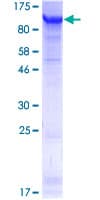 Human FSIP1 Protein (Recombinant GST)