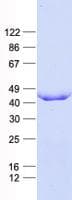 Human EXOG / ENDOGL1 Protein (Recombinant His, N-Terminal)