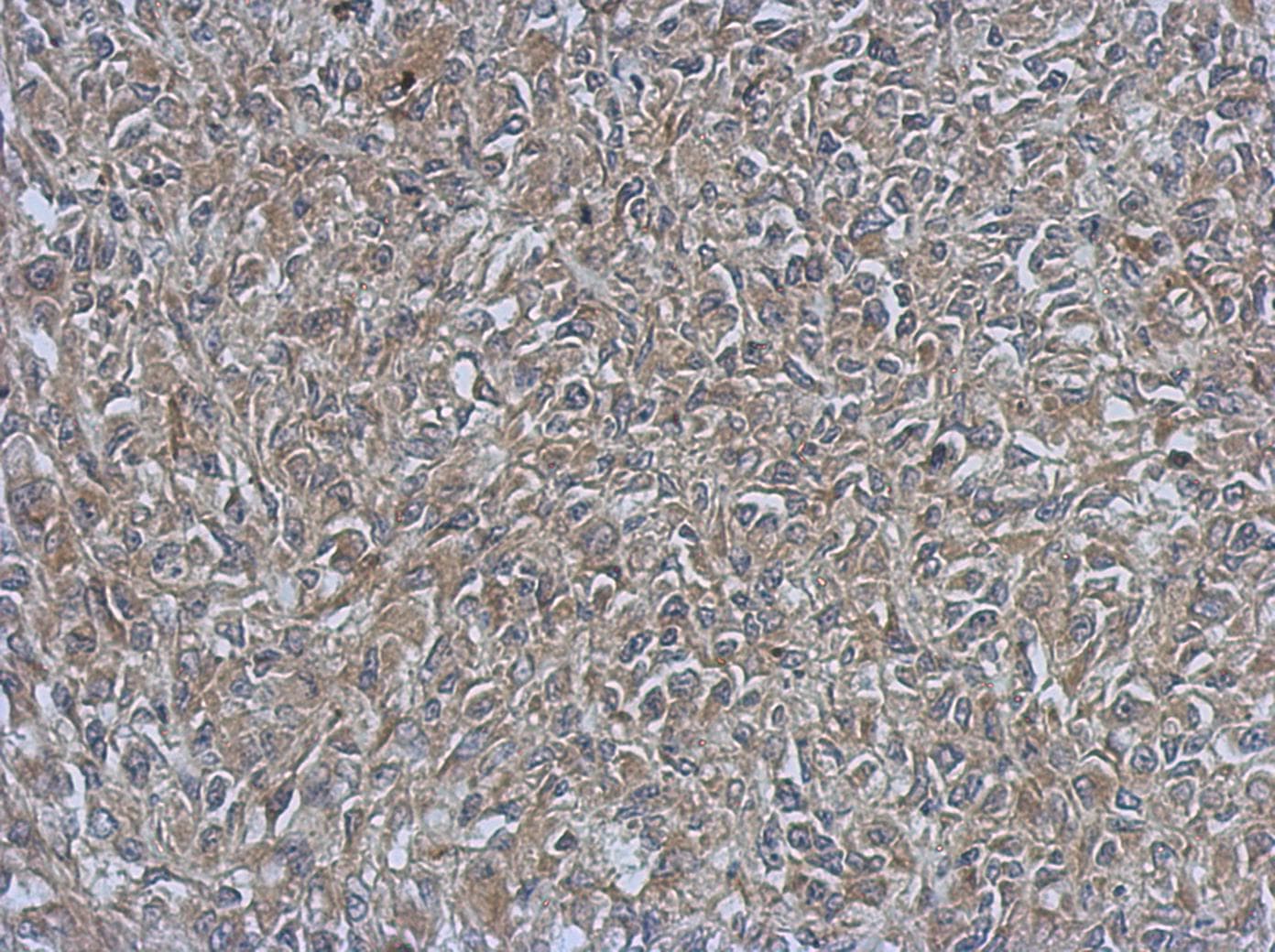 URP2 / FERMT3 Antibody