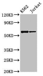 NAMPT / Visfatin Antibody