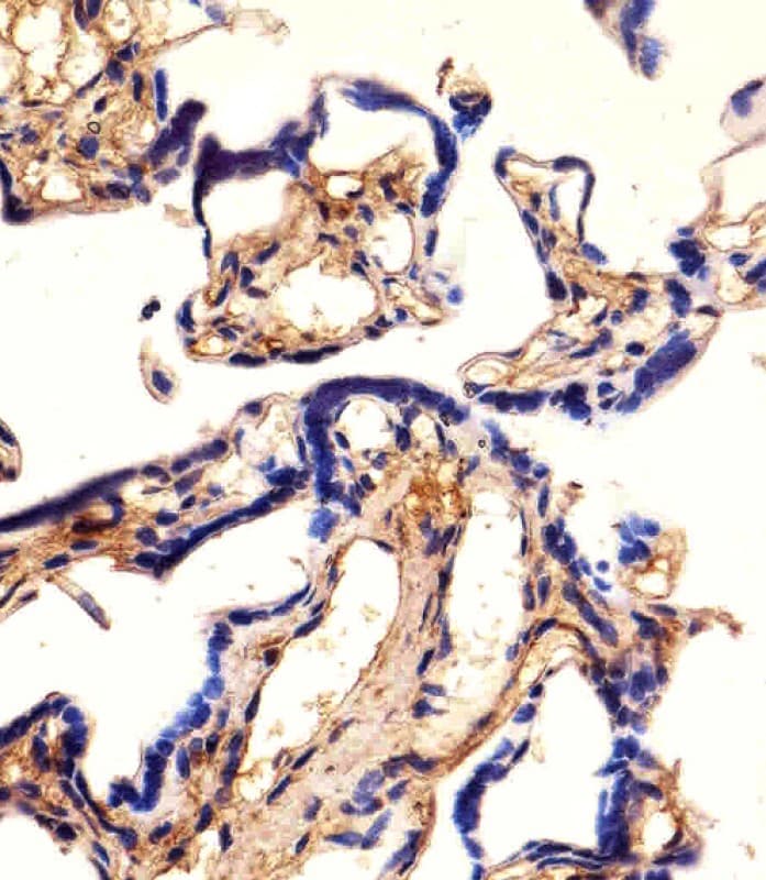 Polyclonal Rabbit anti-Human EHD2 Antibody (aa415-449, IHC, WB)