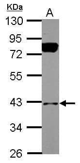 Polyclonal Rabbit anti-Human BNIP2 Antibody (IHC, WB)