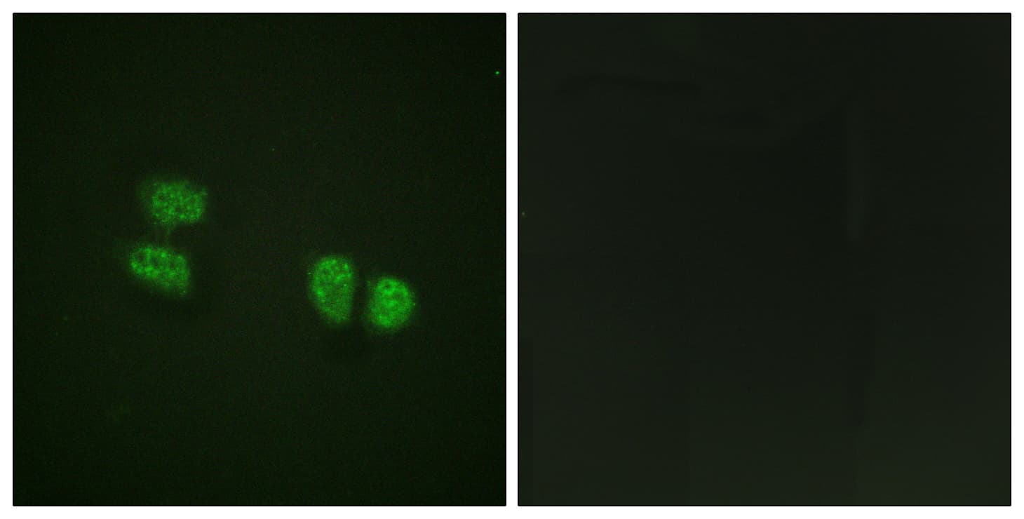 DDX5 Antibody (phospho-Tyr593)