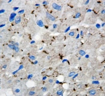 Polyclonal Rabbit anti-Human GJA5 / CX40 / Connexin 40 Antibody (aa341-358, IHC, WB)