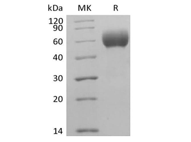 Human SIRPA / CD172a Protein (Recombinant AVI-6His, C-terminus)