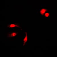 Polyclonal Rabbit anti-Human NFKB1 / NF-Kappa-B Antibody (phospho-Ser927, IHC, IF, WB)
