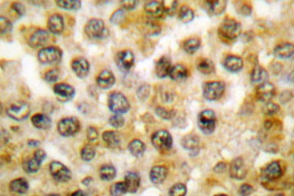 ERK1 + ERK2 Antibody (Leu352)