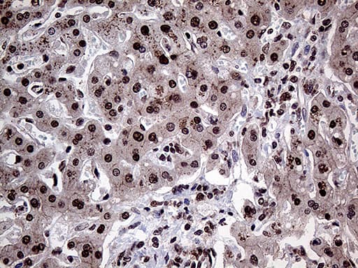 PPP4C Antibody (clone OTI2E4)