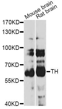 Polyclonal Rabbit anti-Human TH / Tyrosine Hydroxylase Antibody (IHC, WB)