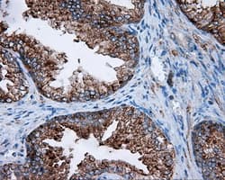 FAHD2A Antibody (clone OTI5G1)