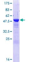 Human TSN / Translin Protein (Recombinant GST)