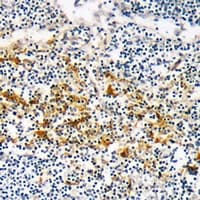 CYSLTR1 / CYSLT1 Antibody (Internal)