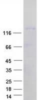 Human SPT5 / SUPT5H Protein (Recombinant Myc-DDK (Flag))