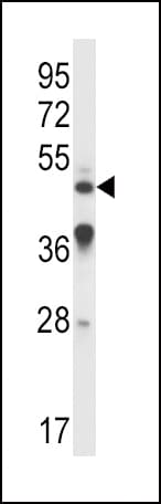 IL9R / CD129 Antibody (aa170-199)