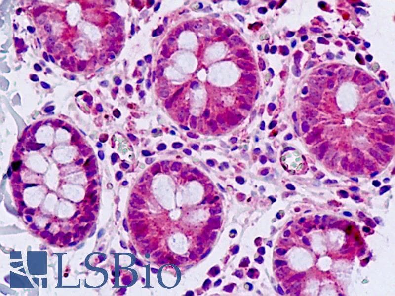 IHC-plus™ SGK3 Antibody (C-Terminus)