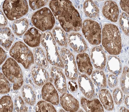 KRT18 / CK18 / Cytokeratin 18 Antibody