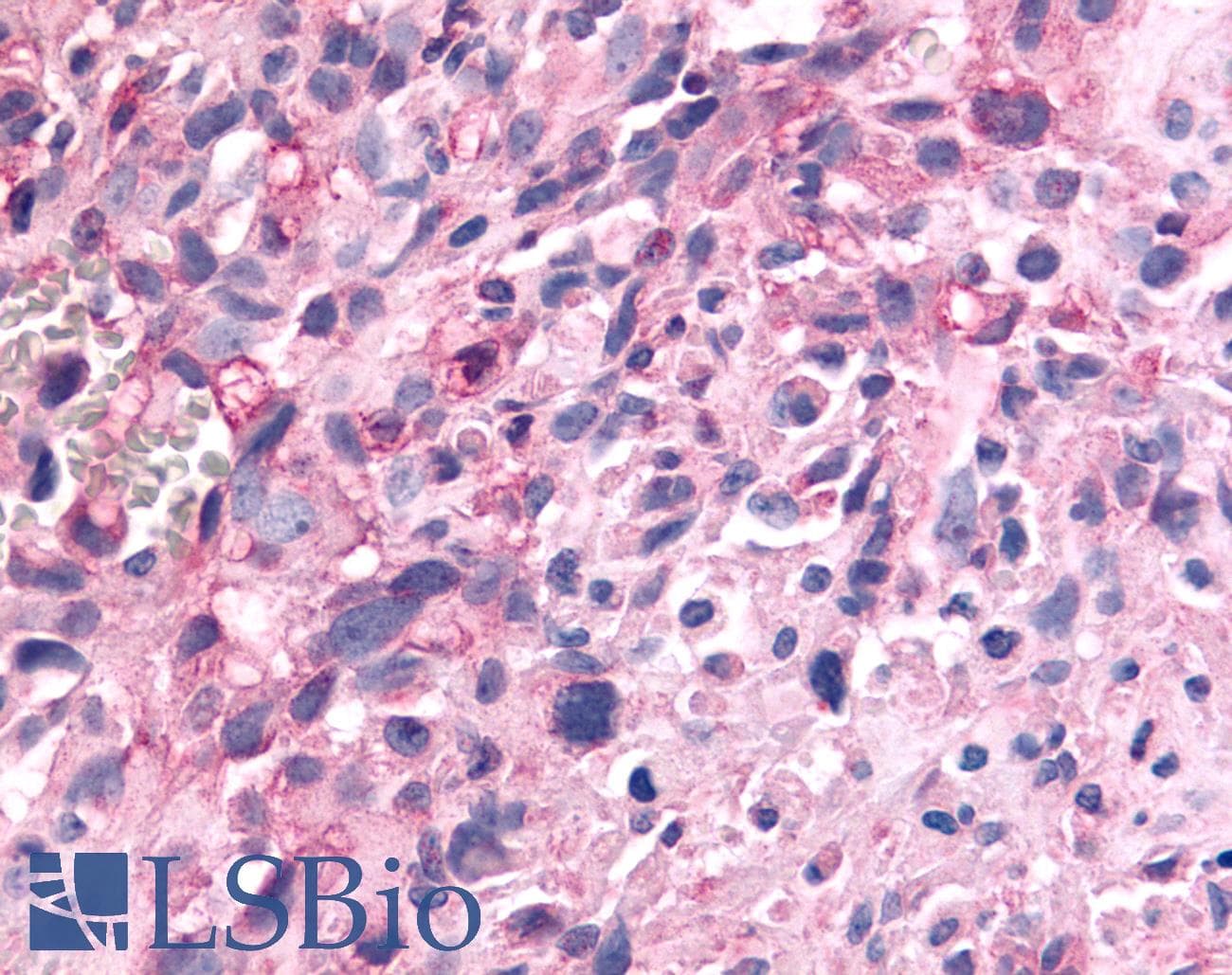 PathPlus™ PTPRE / PTP Epsilon Antibody (Cytoplasmic Domain)