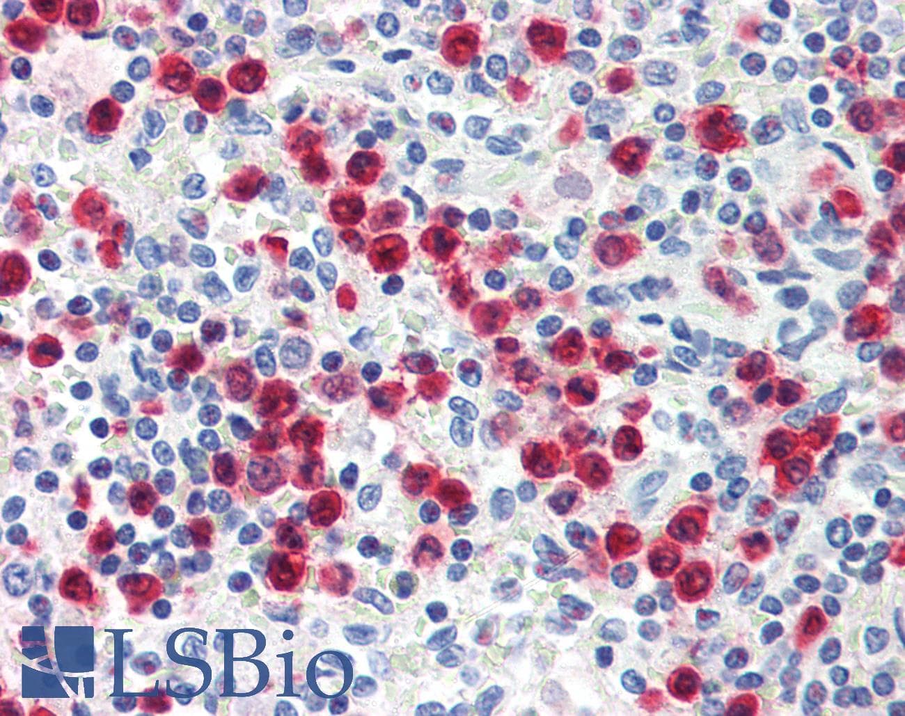 IHC-plus™ Monoclonal Mouse anti-Human S100A8 / MRP8 Antibody (FITC, IHC)