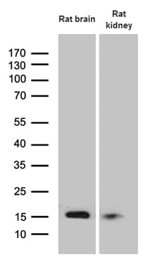 Monoclonal Mouse anti-Human FHIT Antibody (clone OTI2C2, IHC, WB)