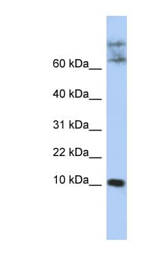 CKLF Antibody (N-Terminus)