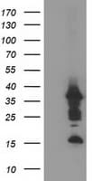 Monoclonal Mouse anti-Human PDLIM2 / SLIM Antibody (clone OTI9B6, WB)