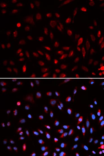 Polyclonal Rabbit anti-Human ERCC1 Antibody (IHC, IF, WB)