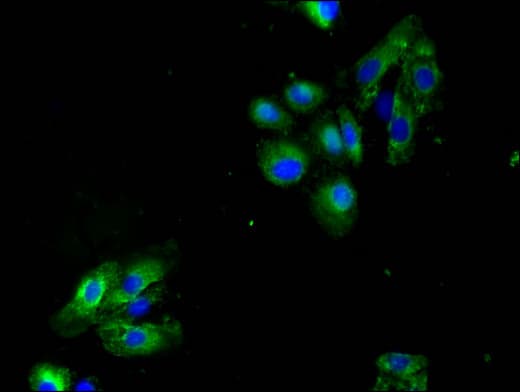Polyclonal Rabbit anti-Human LAX1 / LAX Antibody (IF, WB)
