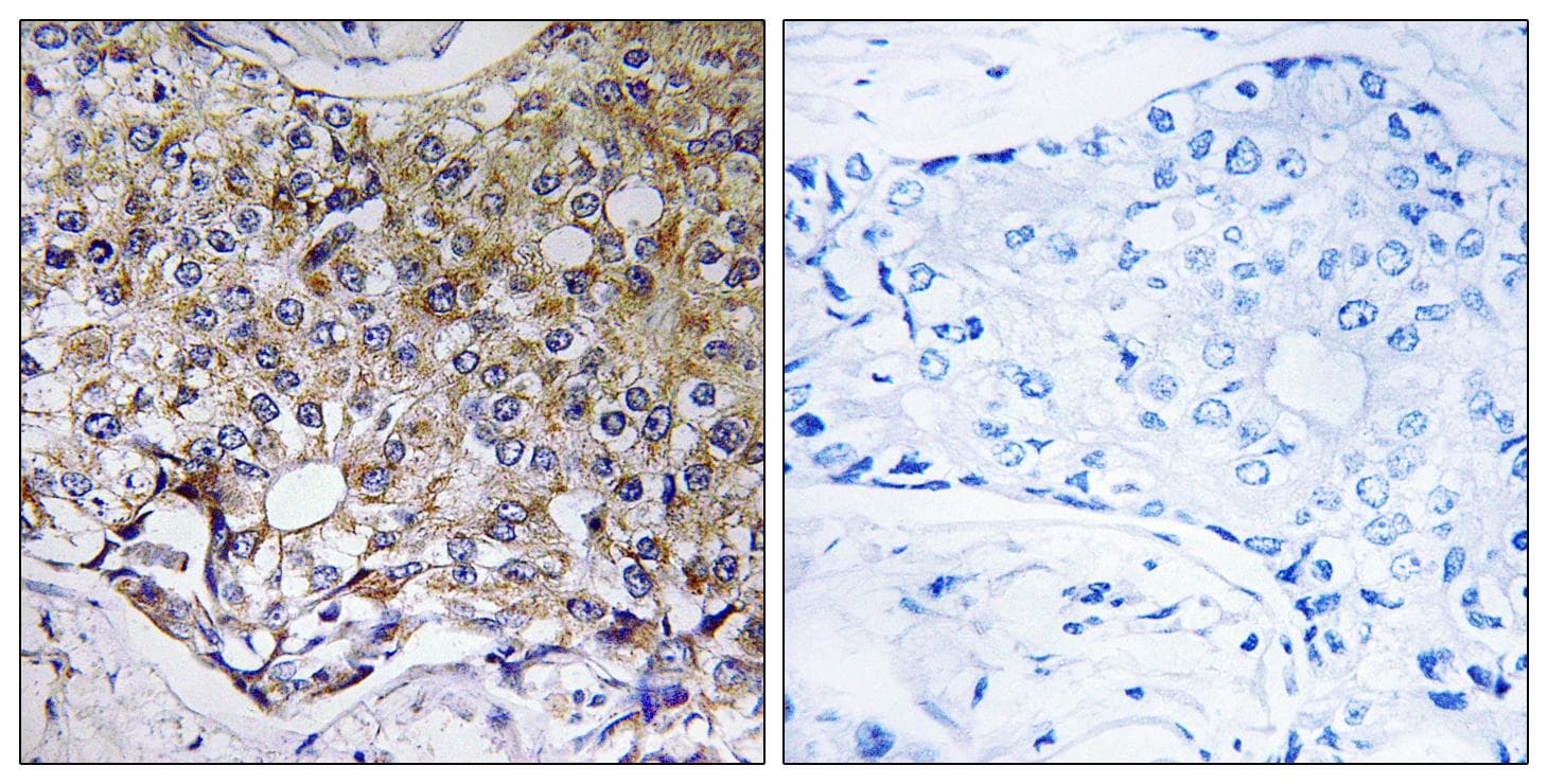 Polyclonal Rabbit anti-Human ATG4A Antibody (IHC, IF)