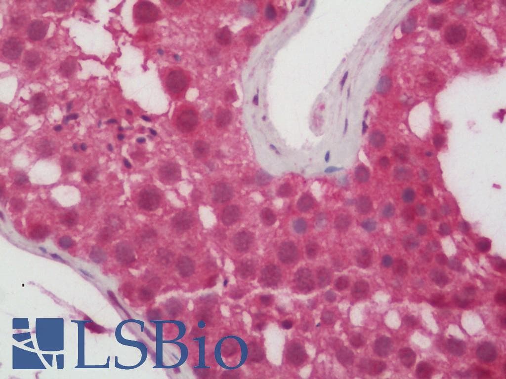 IHC-plus™ Polyclonal Rabbit anti-Human MFN1 Antibody (IHC, WB)