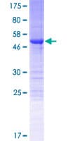 Human NRIP3 Protein (Recombinant GST)
