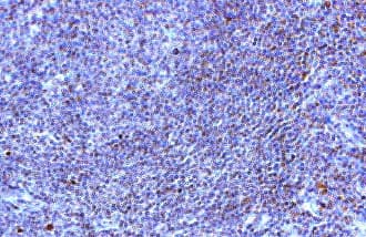 TLR10 Antibody (aa81-111)