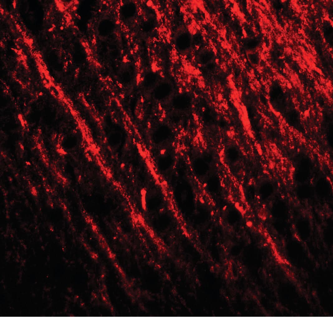 IHC-plus™ PRRT2 Antibody