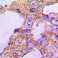 COX5B Antibody (N-Terminus)