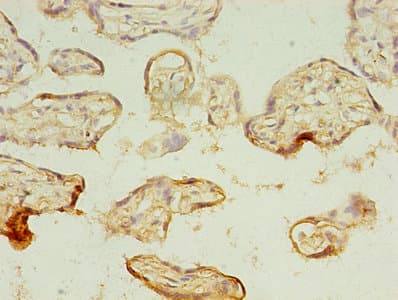 MAGE10 / MAGEA10 Antibody (aa2-225)