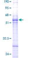 Human ARL6IP1 / ARMER Protein (Recombinant GST)