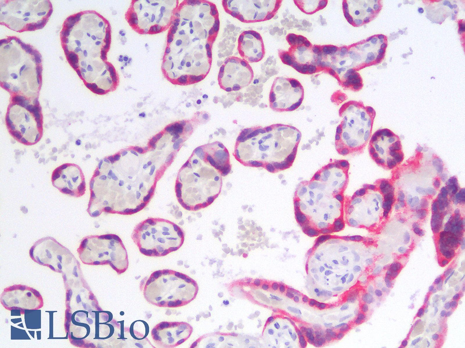 PathPlus™ BCL2 / Bcl-2 Antibody (clone rBCL2/782)