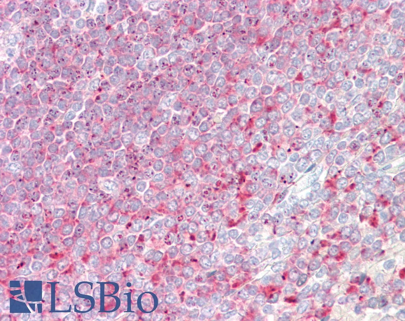 IHC-plus™ D52 / TPD52 Antibody (aa213-223)