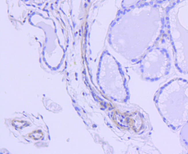 Rho Kinase / ROCK1 Antibody