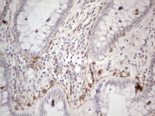 PDGFRA / PDGFR Alpha Antibody (aa789-1089, clone OTI1C10)