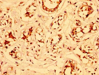 ESRP2 / RBM35B Antibody