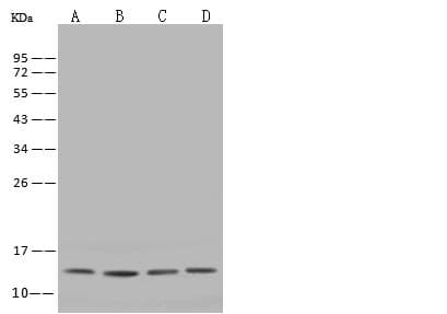 Polyclonal Rabbit anti-Human FAU / Fub1 Antibody (IHC, WB)