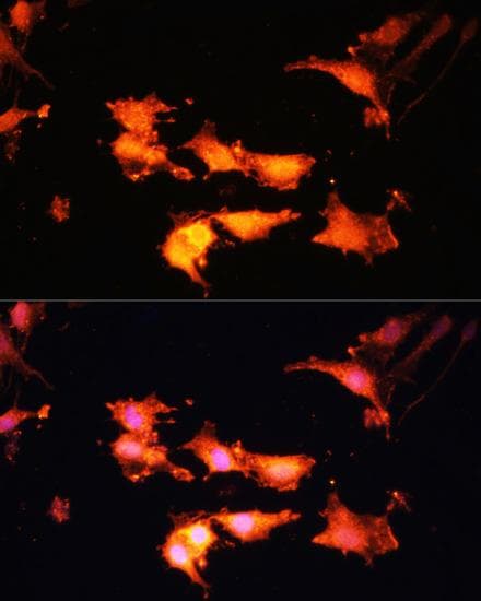 FLCN / Folliculin Antibody