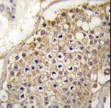 PIP4K2C Antibody (aa333-364)