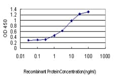 IHC-plus™ BAG1 / BAG-1 Antibody (clone 2D3)