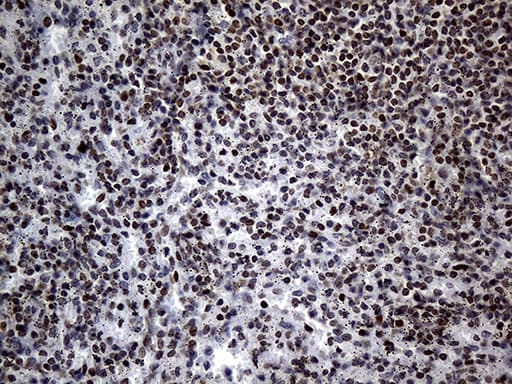 PPARD / PPAR Delta Antibody (aa1-244, clone OTI4D10)