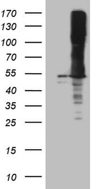 ASS1 / ASS Antibody (C-Terminus, clone OTI4C9, Carrier-free)